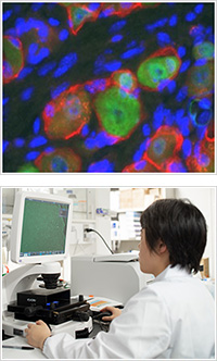 痛み慢性化の機序の探究